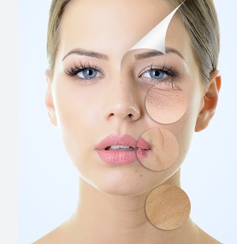 Skin Rejuvenation